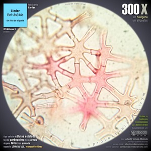 Parénquima aerífero